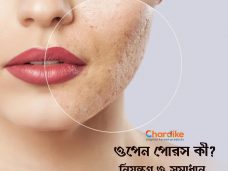 ওপেন পোরস কী