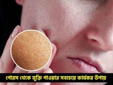 পোরস দূর করতে করণীয়
