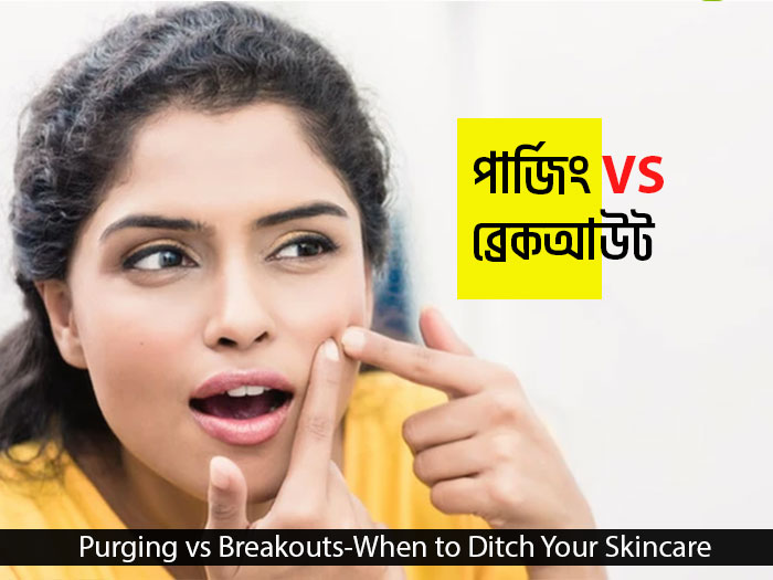 Purging vs Breakouts-When to Ditch Your Skincare