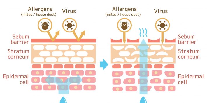 স্কিন ব্যারিয়ার