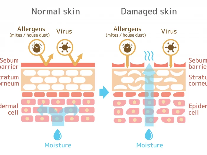 স্কিন ব্যারিয়ার