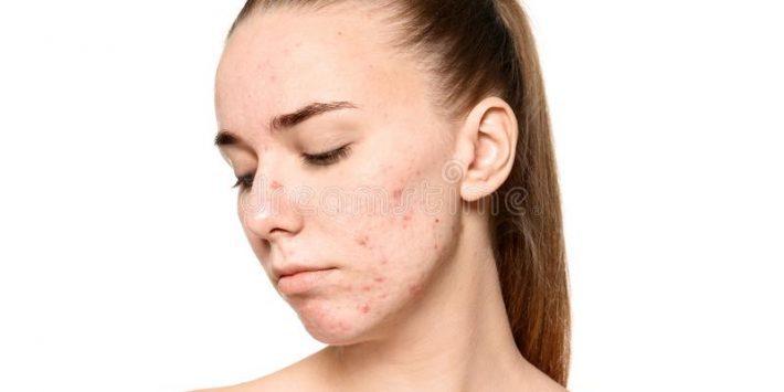 ব্রন থেকে মুক্তি