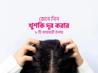 জেনে নিন খুশকি দূর করার ৮ টি কার্যকরী উপায়